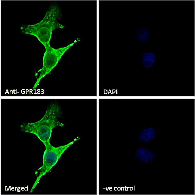 GPR183 Antibody in Immunocytochemistry (ICC/IF)