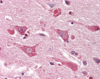 MYO1B Antibody in Immunohistochemistry (Paraffin) (IHC (P))