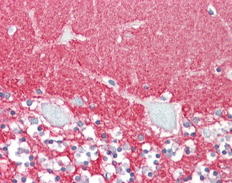 GPM6A Antibody in Immunohistochemistry (Paraffin) (IHC (P))