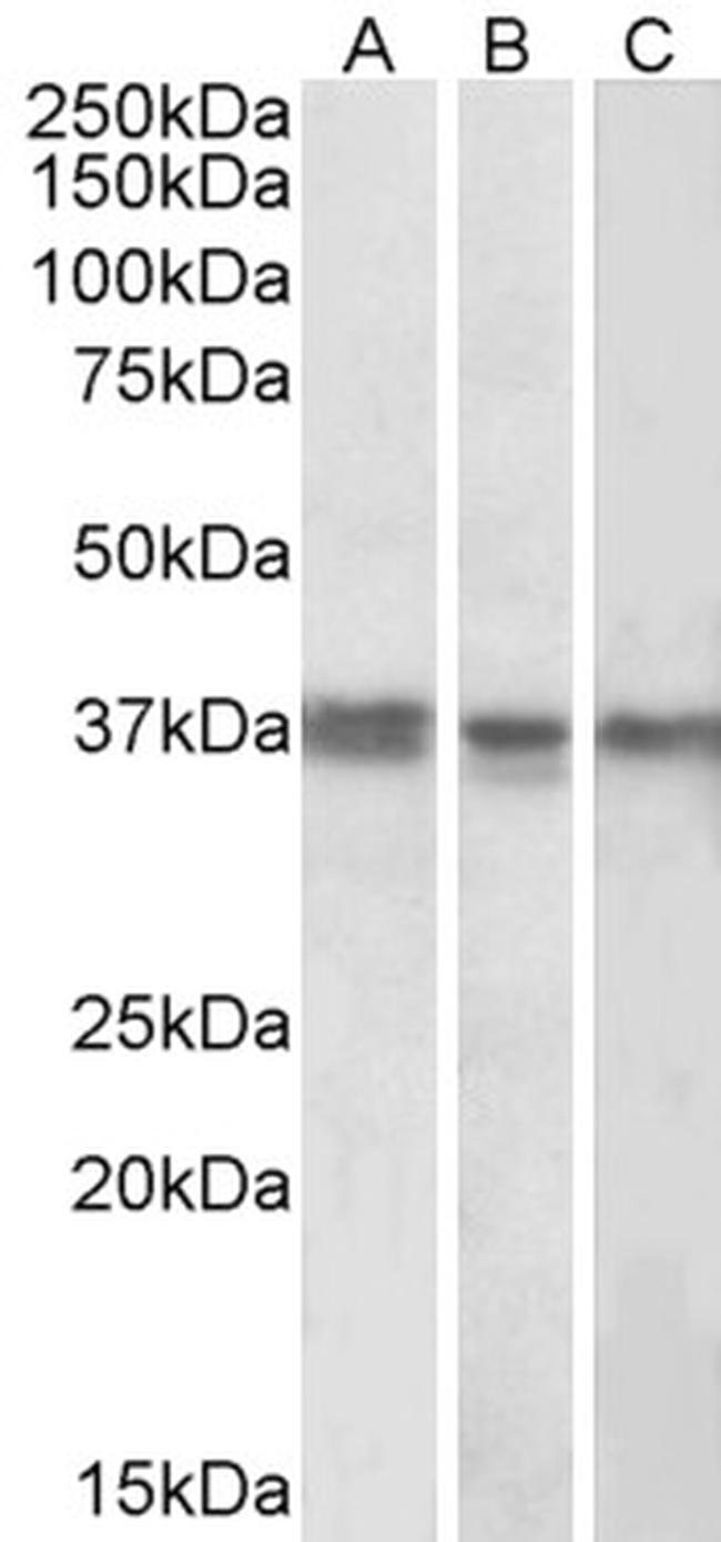 POLDIP2 Antibody in Western Blot (WB)