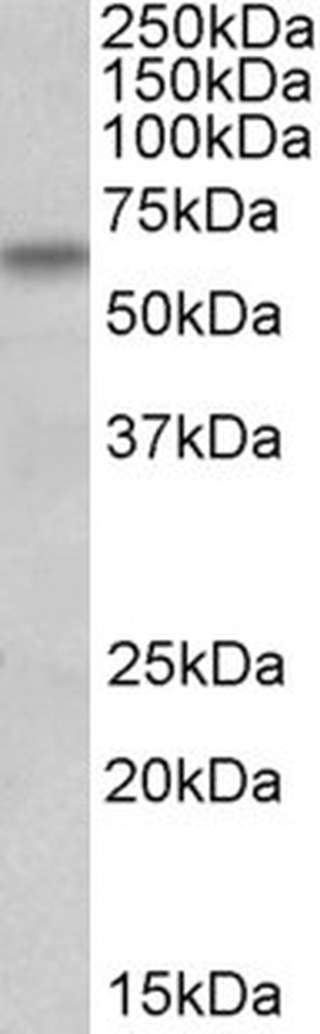 BBS4 Antibody in Western Blot (WB)