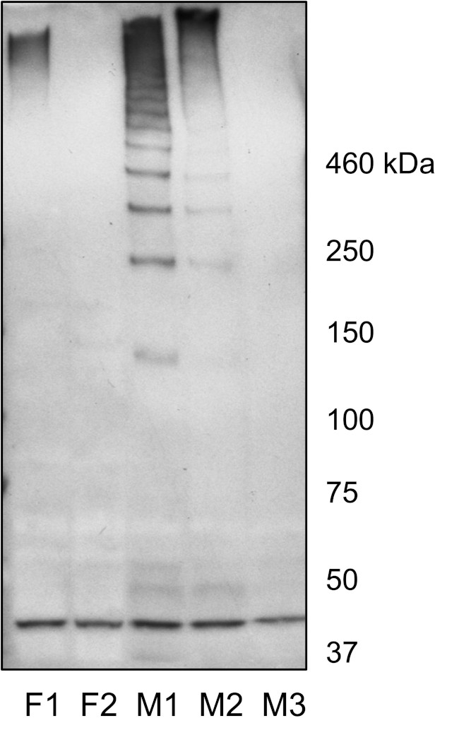 Mucin 19 Antibody in Western Blot (WB)