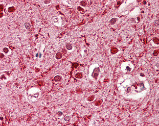 ASCL3 Antibody in Immunohistochemistry (Paraffin) (IHC (P))