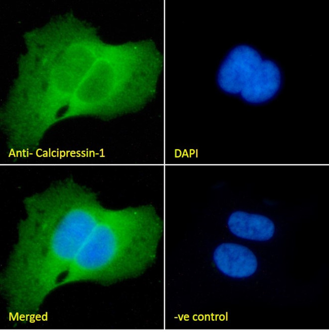 RCAN1 Antibody in Immunocytochemistry (ICC/IF)