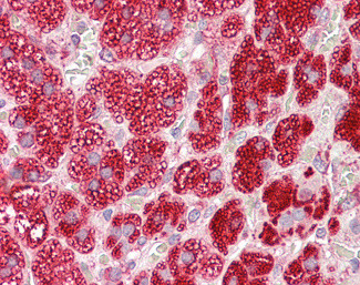 CYB5R3 Antibody in Immunohistochemistry (Paraffin) (IHC (P))