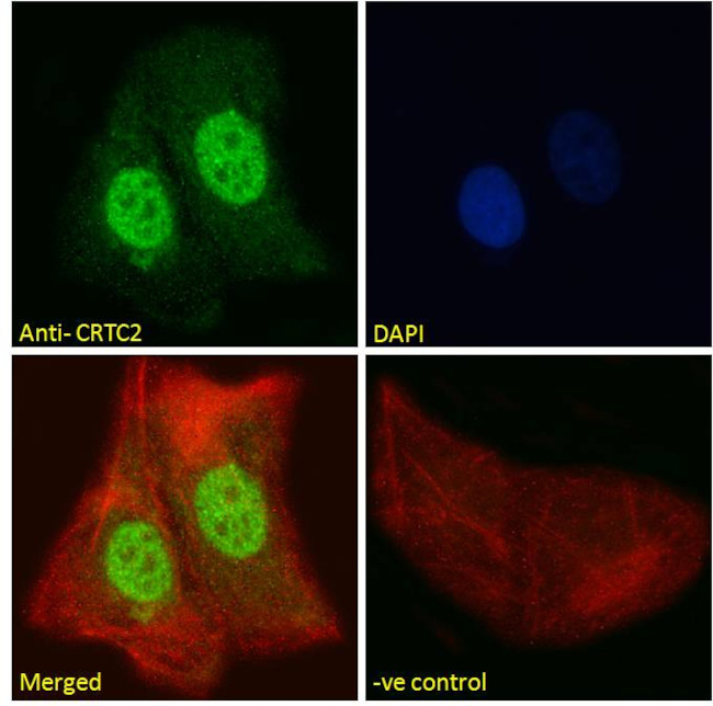 TORC2 Antibody in Immunocytochemistry (ICC/IF)