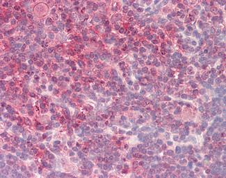 TORC2 Antibody in Immunohistochemistry (Paraffin) (IHC (P))