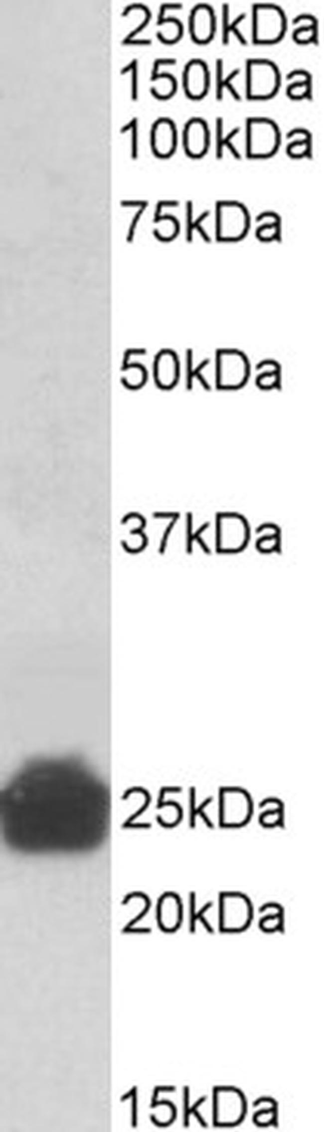 GSTA3/GSTA5 Antibody in Western Blot (WB)