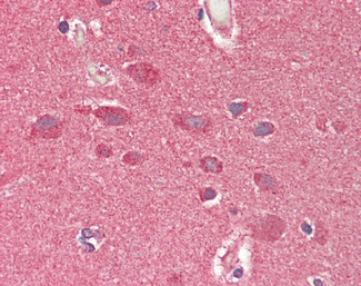 CROT Antibody in Immunohistochemistry (Paraffin) (IHC (P))