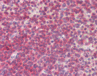 BLK Antibody in Immunohistochemistry (Paraffin) (IHC (P))