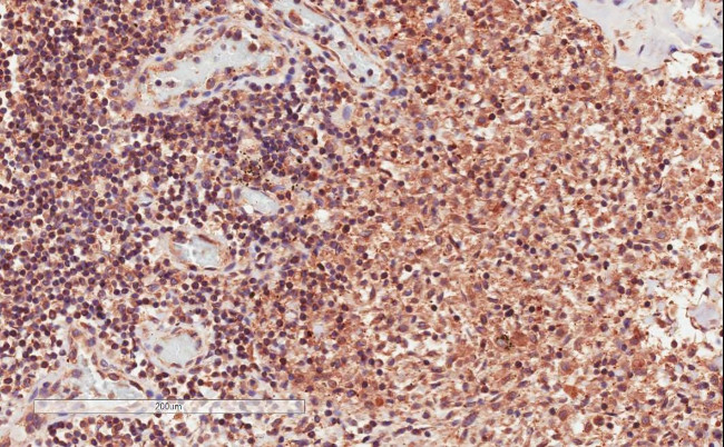 CD28 Antibody in Immunohistochemistry (Paraffin) (IHC (P))