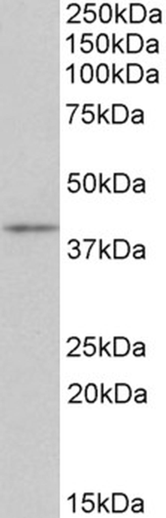 CD28 Antibody in Western Blot (WB)