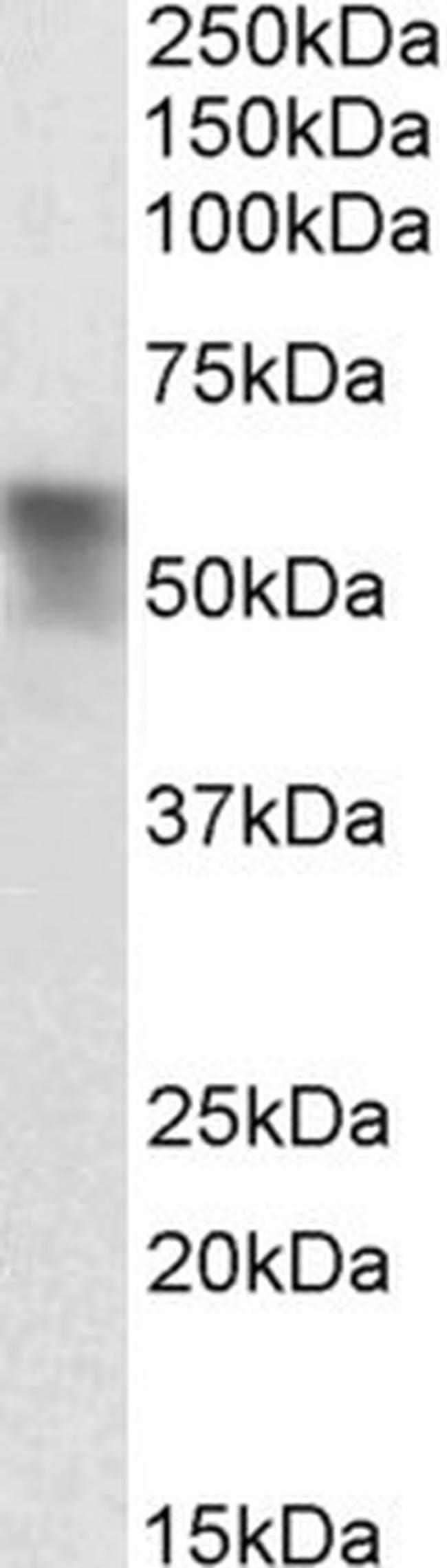 SERPINA6 Antibody in Western Blot (WB)