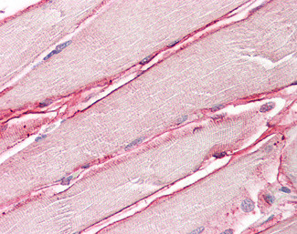 SGCD Antibody in Immunohistochemistry (Paraffin) (IHC (P))