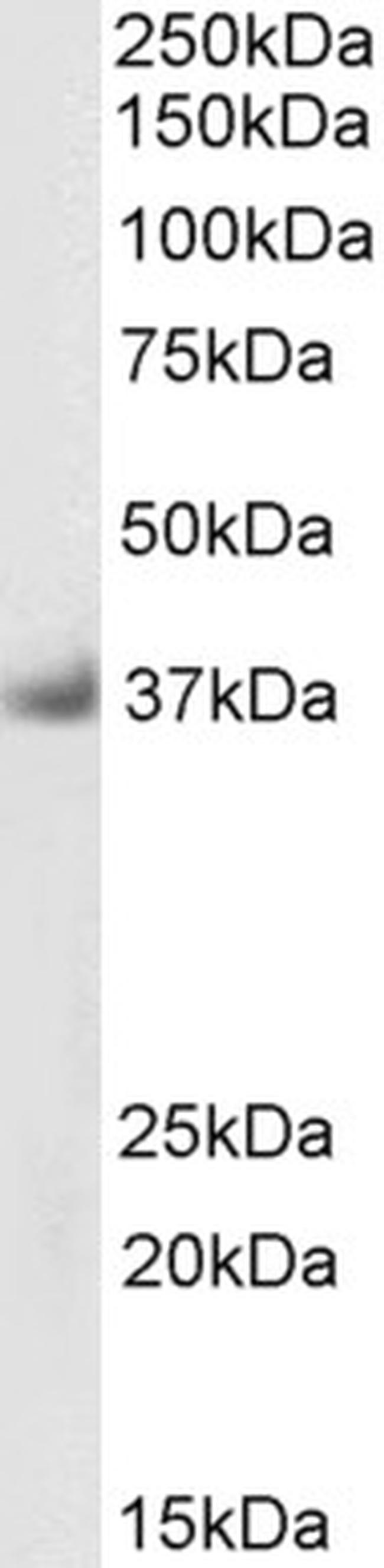 SGCD Antibody in Western Blot (WB)