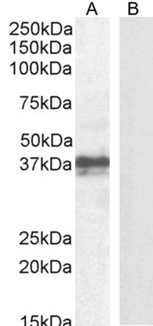FOXI3 Antibody in Western Blot (WB)