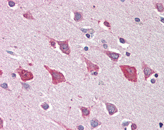MOB4 Antibody in Immunohistochemistry (Paraffin) (IHC (P))