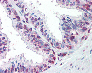 ZIC3 Antibody in Immunohistochemistry (Paraffin) (IHC (P))