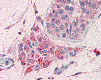 PIM2 Antibody in Immunohistochemistry (Paraffin) (IHC (P))