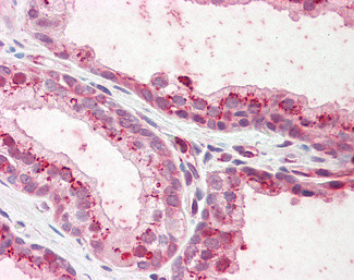 PKP2 Antibody in Immunohistochemistry (Paraffin) (IHC (P))