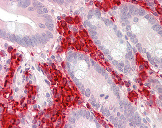 TXNDC5 Antibody in Immunohistochemistry (Paraffin) (IHC (P))