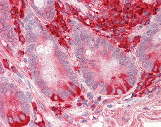 TXNDC5 Antibody in Immunohistochemistry (Paraffin) (IHC (P))