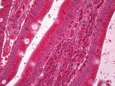 ERO1L Antibody in Immunohistochemistry (Paraffin) (IHC (P))