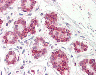 UBASH3A Antibody in Immunohistochemistry (Paraffin) (IHC (P))