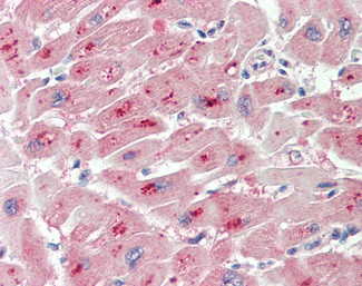 PIM2 Antibody in Immunohistochemistry (Paraffin) (IHC (P))