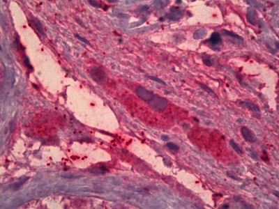 ITIH4 Antibody in Immunohistochemistry (Paraffin) (IHC (P))