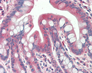 TXNDC11 Antibody in Immunohistochemistry (Paraffin) (IHC (P))
