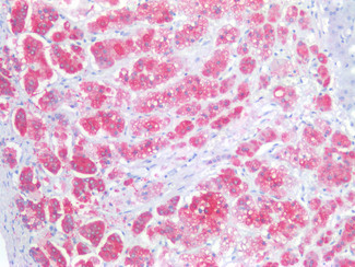 CD56 (NCAM) Antibody in Immunohistochemistry (Paraffin) (IHC (P))
