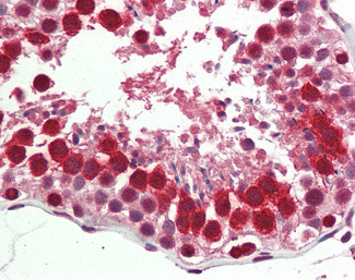RTCB Antibody in Immunohistochemistry (Paraffin) (IHC (P))
