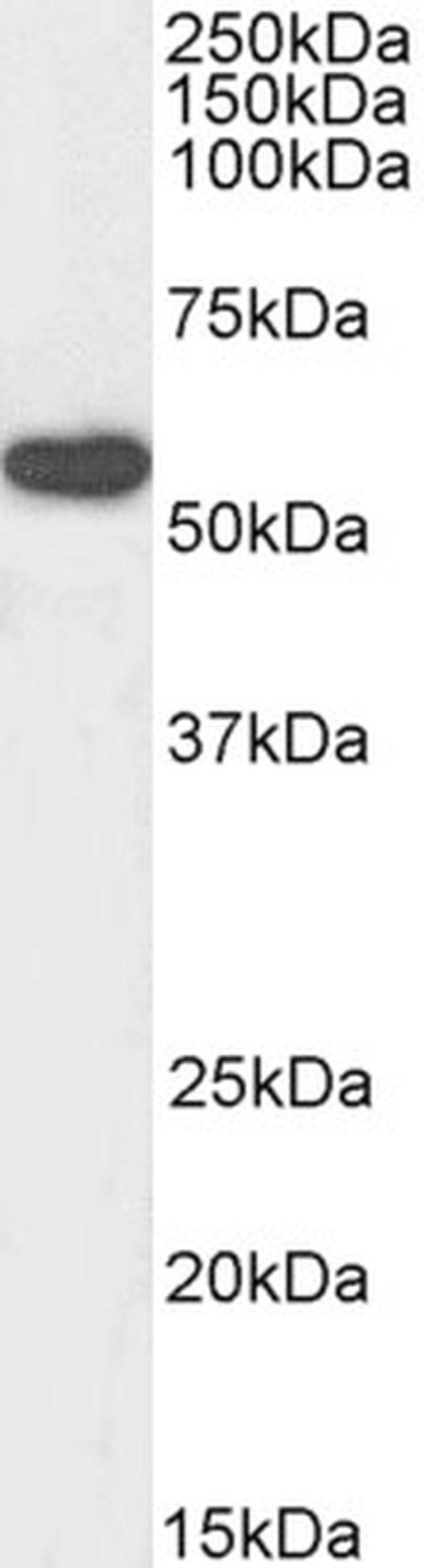 RTCB Antibody in Western Blot (WB)
