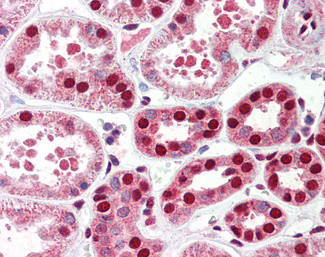 RTCB Antibody in Immunohistochemistry (Paraffin) (IHC (P))