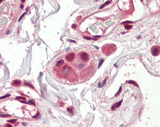 AES Antibody in Immunohistochemistry (Paraffin) (IHC (P))