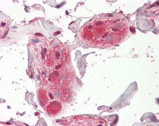 CHRNA5 Antibody in Immunohistochemistry (Paraffin) (IHC (P))