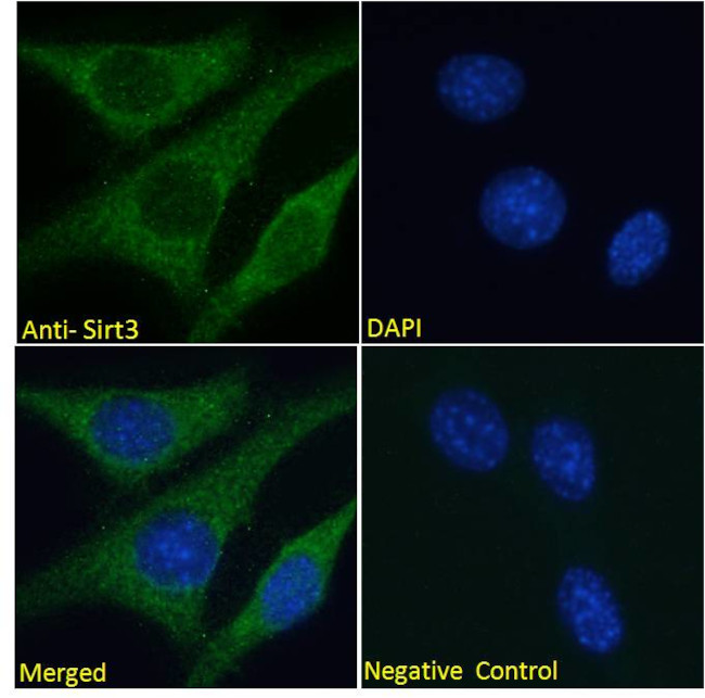 SIRT3 Antibody in Immunocytochemistry (ICC/IF)