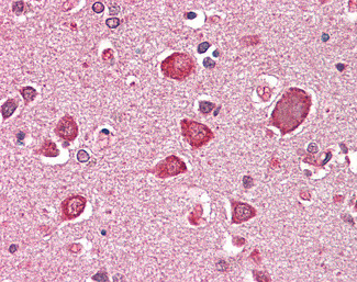 GABRA6 Antibody in Immunohistochemistry (Paraffin) (IHC (P))