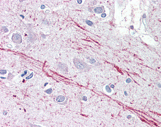 IGF2 Antibody in Immunohistochemistry (Paraffin) (IHC (P))