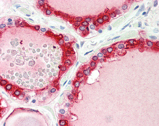 Thyroid Peroxidase Antibody in Immunohistochemistry (Paraffin) (IHC (P))