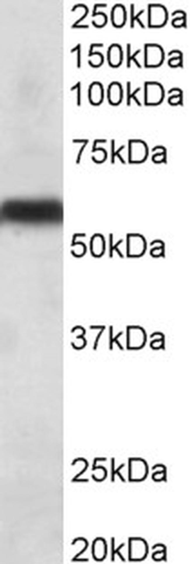 CYP2C8 Antibody in Western Blot (WB)