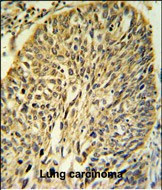FKBP9 Antibody in Immunohistochemistry (Paraffin) (IHC (P))