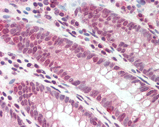 DEFB107A Antibody in Immunohistochemistry (Paraffin) (IHC (P))