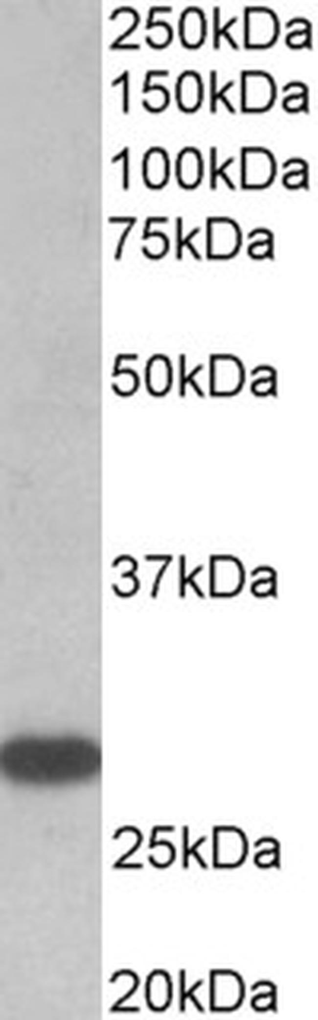 TSH Receptor Antibody in Western Blot (WB)