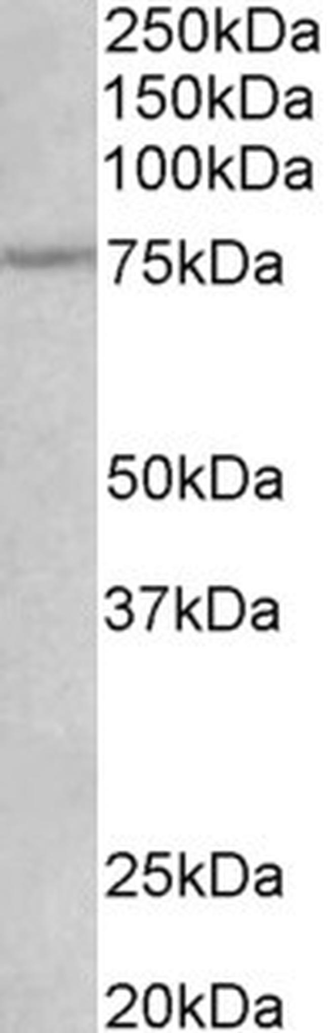 NGFR Antibody in Western Blot (WB)