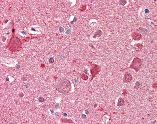 DOC2A Antibody in Immunohistochemistry (Paraffin) (IHC (P))