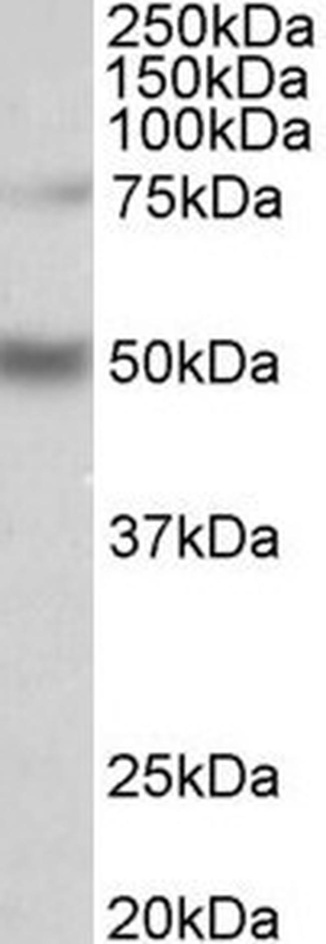 ULK3 Antibody in Western Blot (WB)