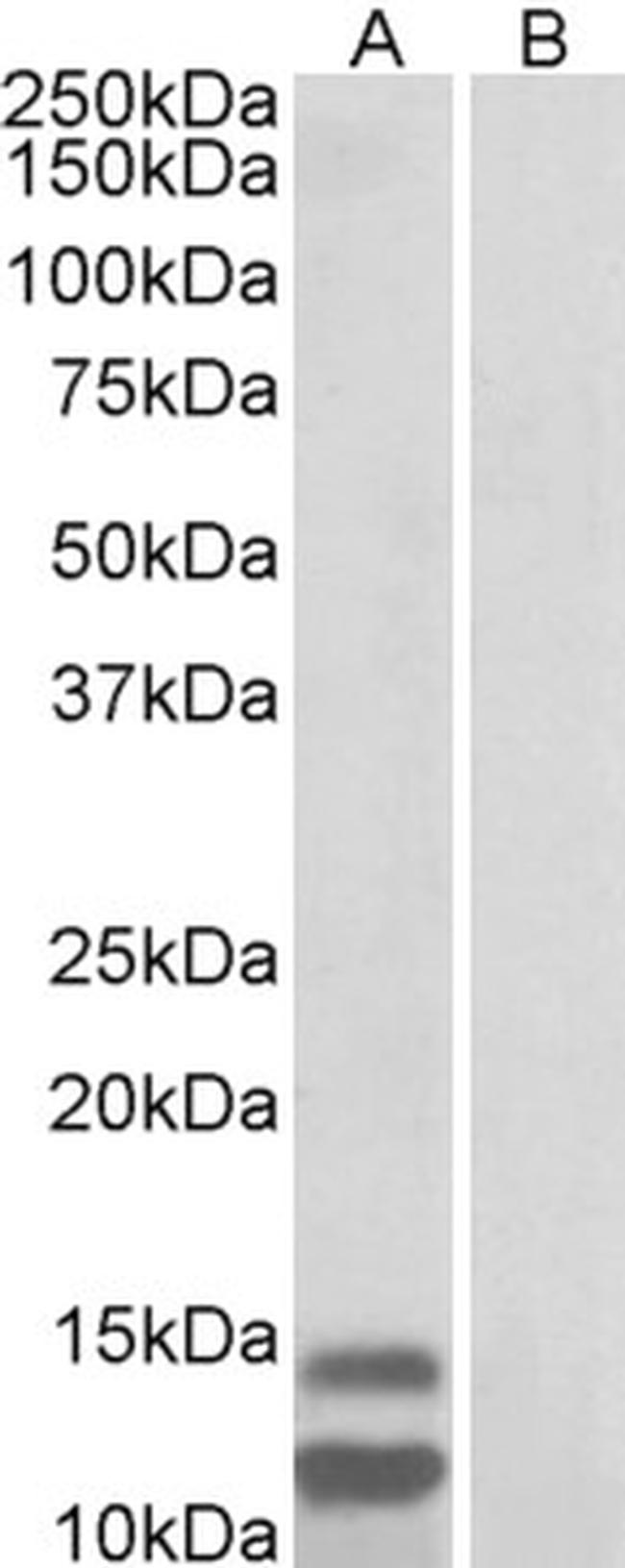 CDKN2B (Isoform 2) Antibody in Western Blot (WB)