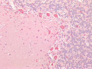 beta-3 Adrenergic Receptor Antibody in Immunohistochemistry (Paraffin) (IHC (P))